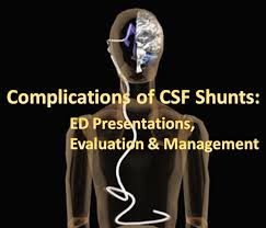 Emdocs Net Emergency Medicine Educationcomplications Of Csf Shunts Ed Presentations Evaluation And Management Emdocs Net Emergency Medicine Education