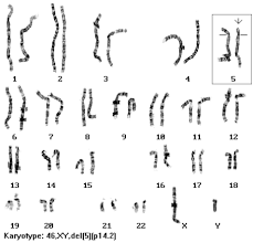 Human Chromosomal Disorders