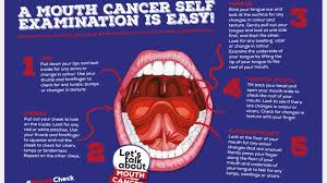 Smartasset, and authorize what does mouth cancer look like both stocks + mp3 format. Let S Talk About Mouth Cancer Posts Facebook