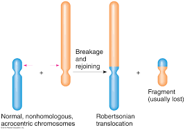 Robertsonian translocations!in robertsonian translocations the transfer of genetic material occurs in only one direction!robertsonian translocations are associated with phenotypic abnormalities or even lethality.!example: Robertsonian Translocation
