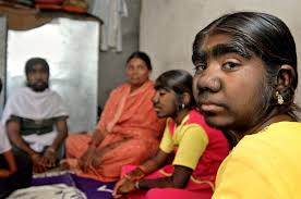 India, le donne licantropo