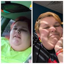 Today I came across this image and I confess: it touched me deeply. On the  left, a CT scan of an obese woman. On the right of a fairly weighted woman.  Seeing