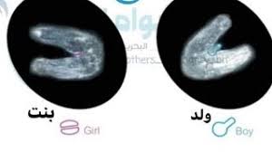 اشتراطات السلامة في مواقع الإنشاءات اشتراطات عامة للسلامة في مواقع الإنشاءاتيجب على صاحب العمل التأكد من أن المقاول المتعاقد معه مرخص ومؤهل للقيام بالأعمال المطلوبة كما يجب عليه إلزامه باتخاذ جميع الإجراءات الوقائية اللازمة لحماية. Ø§Ù„ÙØ±Ù‚ Ø¨ÙŠÙ† Ø³ÙˆÙ†Ø§Ø± Ø§Ù„ÙˆÙ„Ø¯ ÙˆØ³ÙˆÙ†Ø§Ø± Ø§Ù„Ø¨Ù†Øª ÙÙŠ Ø§Ù„Ø´Ù‡Ø± Ø§Ù„Ø«Ø§Ù„Ø« Ù…Ù† Ø§Ù„Ø­Ù…Ù„ Youtube