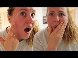 Are Poolankilangu (White Turmeric) And Kasturi Manjal (Wild Turmeric)  Supposed To Cause Some Mild Burning Sensation When Applied On The Face? -  Quora