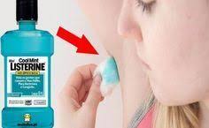 Utilidades Milagrosas Do Listerine Listerine Como Tratar Acne Aprendiz De Cabeleireira