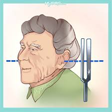 Image result for Tuning Fork Test