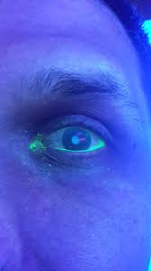 If you have a scratched eye, it is most like­ly in the area of the eye known as your cornea. Scratched My Cornea Album On Imgur