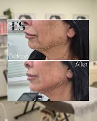 Instagram photo by Dr Eli Shulman • aesthetic & beauty • Dec 10, 2024 at  11:10 PM