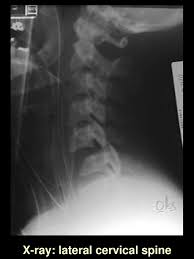 Please understand that our phone lines must be clear for urg. 25 Yo Healthy Male College Student Ppt Download