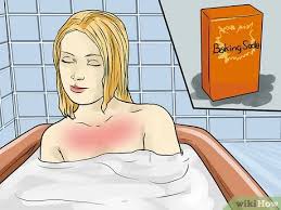 Check spelling or type a new query. How To Prevent Skin Peeling After Sunburn 15 Steps