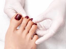 Image result for Pitting nails feet