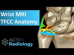 The tfcc is located at the ulnar wrist, articulating with the head of the ulna proximally and the the gold standard for assessing the integrity of the tfcc is arthroscopy. Mri Anatomy Of Tfcc Youtube