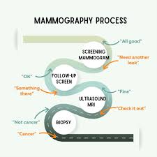 Image result for Mammogram Interpretation