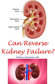 Causes Of Kidney Infection In Females Kidney Disease Symptoms Renal Diet Kidney Disease Recipes