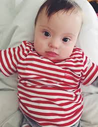 Baby With Down Syndrome Signs With Same Modeling Agency As His Mom Down Syndrome Baby Model Agency Down Syndrome