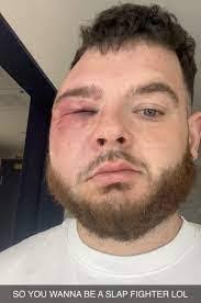 Roger Anson's Instagram, Twitter & Facebook