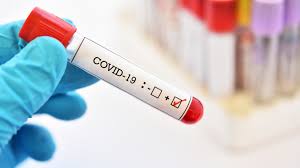Tests (pooled tests and rapid tests) that turn out positive must be immediately confirmed with pcr tests. Informationen Was Ist Zu Tun Bei Positivem Pcr Test Deutschsprachiges Studium