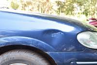 نتیجه جستجوی لغت [dent] در گوگل