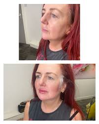 Bardot Aesthetics Ltd (@bardotaestheticsltd) • Instagram photos and videos