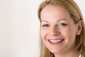 Gerade zähne für jung und alt. Was Ist Bei Der Zahnregulierung Fur Erwachsene Zu Beachten Dr Koneke Aus Kiel Gibt Antwort