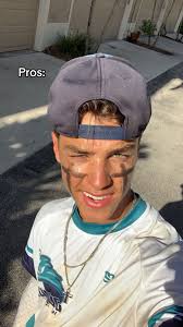 Exploring the Pros and Cons of Having Green Eyes