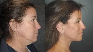 Scots plastic surgery clinic falsely passing off celebrity surgeon's work  to advertise own services