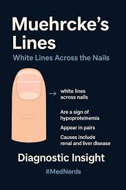 Image result for Muehrcke Line