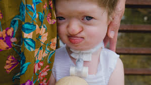 Fundraiser by Anna Owen : Mobility Bicycle for Josephine!