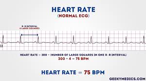 We did not find results for: How To Read An Ecg Ecg Interpretation Ekg Geeky Medics