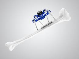 Image result for Orthopichonia