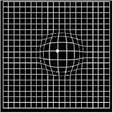 Pdf A Study On Amslers Grid In Acquired Macular Disorders