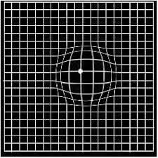 Pdf A Study On Amslers Grid In Acquired Macular Disorders