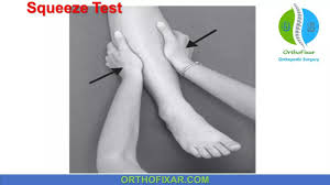 Image result for Ankle External Rotation Test
