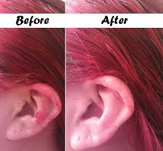 Testing out 5 hair dye removal methods, i'll show you side by side comparisons on difficult to remove colours to find out which method is best. Useful Ideas On How To Remove Hair Dye From Skin Alldaychic