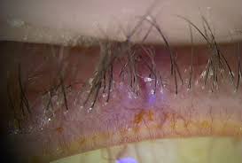 Image result for Blepharis affinis