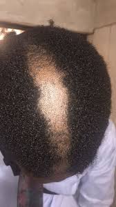 • 657 просмотров 4 месяца назад. Covenant University One Inch Hair No Bia Bia And Oda Ways To Be Di Total Man Bbc News Pidgin