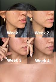 Skinbetter Science Review