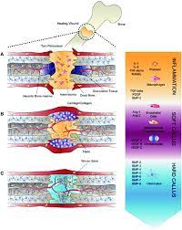 Bone Fracture Healing Steps A Spatiotemporal Cascade Of Gfs Regulates Download Scientific Diagram