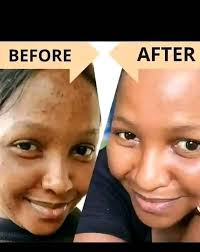 available malato soap and malato oil face cream available Bauchi State  kofar idi anaturawa ko ina WhatsApp number 07015981211