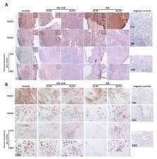 Van lienden groenprojecten wordt geleid door glenn van lienden. Ijms Free Full Text Human Lymph Node Stromal Cells Have The Machinery To Regulate Peripheral Tolerance During Health And Rheumatoid Arthritis