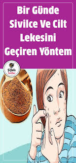 Bir Gunde Sivilce Ve Cilt Lekesini Geciren Yontem Sivilce Genellikle Ergenlik Donemlerinde Kendini Gostermeye Baslayan Dogal Cilt Bakimi Dogal Dogal Saglik