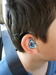 Pin On Deaf Hearing Aid Pimping