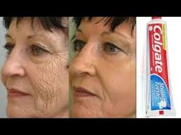 Did You Know That Colgate Toothpaste Can Remove Wrinkles And Finelines Youtube Wrinkle Remover Colgate Toothpaste Vaseline For Face