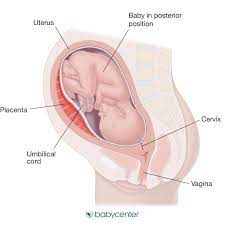 Occiput Posterior Position In Labor Babycenter