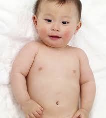 How To Treat Baby S Stomach Related Illnesses Parents