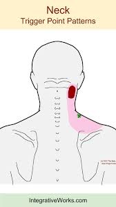 Pin On Acupuncture