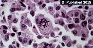 When they've started on the domestic path together, the defenses start to come down, and all energy goes into creating a cozy home. In The Way Cancer Cells Work Together A Possible Tool For Their Demise The New York Times