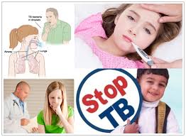 Waspadai Tuberkulosis pada Anak, Inilah Upaya Pencegahannya!