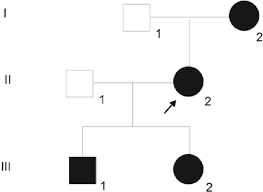 Pedigree Chart Showing Four Patients From Three Generations