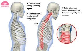 Mau tahu gosip terpanas seputar selebriti tanah air lainnya? Testimoni Flex Tulang Belakang Terkunci Keluarga Hilang Punca Pendapatan Flexphysiotherapy